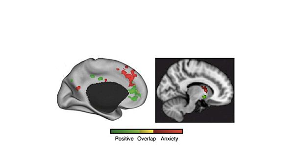 New Brain Study Shows Why Making Difficult Choices Sucks