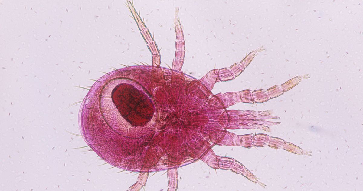 Introducing Rat Mites Theyre Even Worse Than Bedbugs 