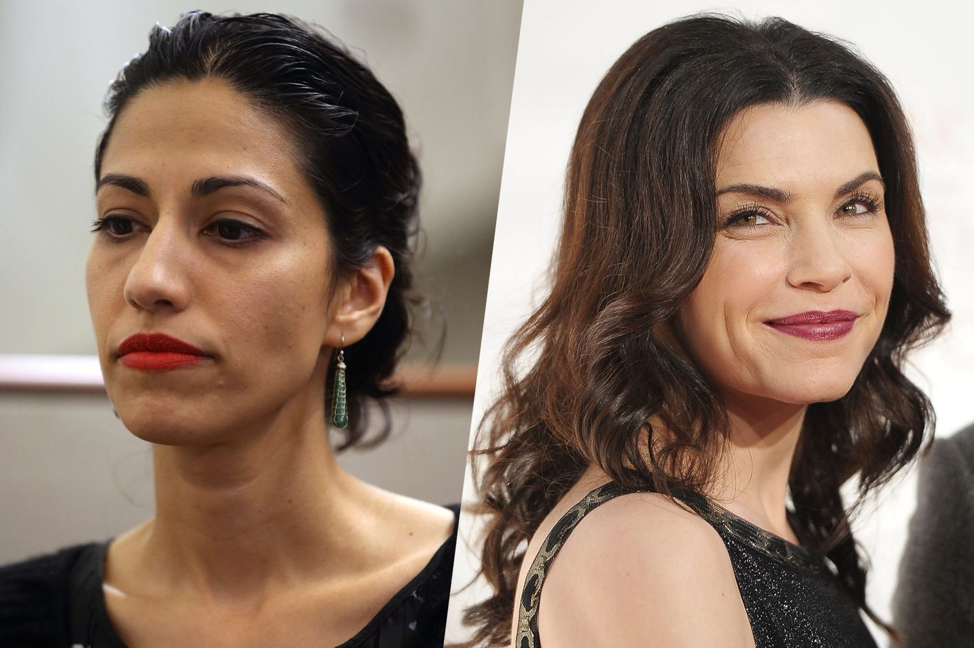 Julianna margulies plastic surgery