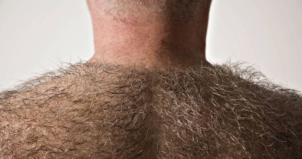Extremely Hairy Man