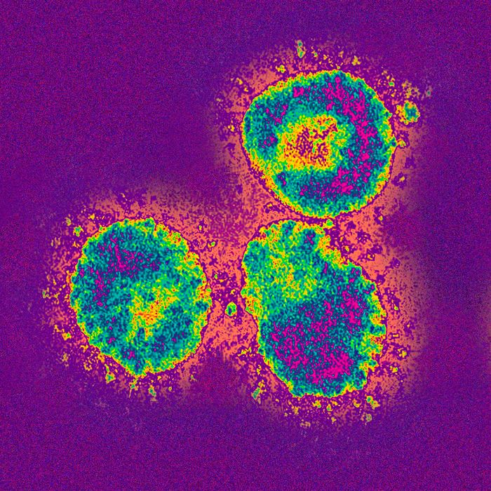 Is ‘Viral Load’ Key to Understanding Coronavirus’s Severity?