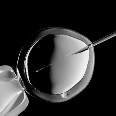 In vitro fertilisation, illustration