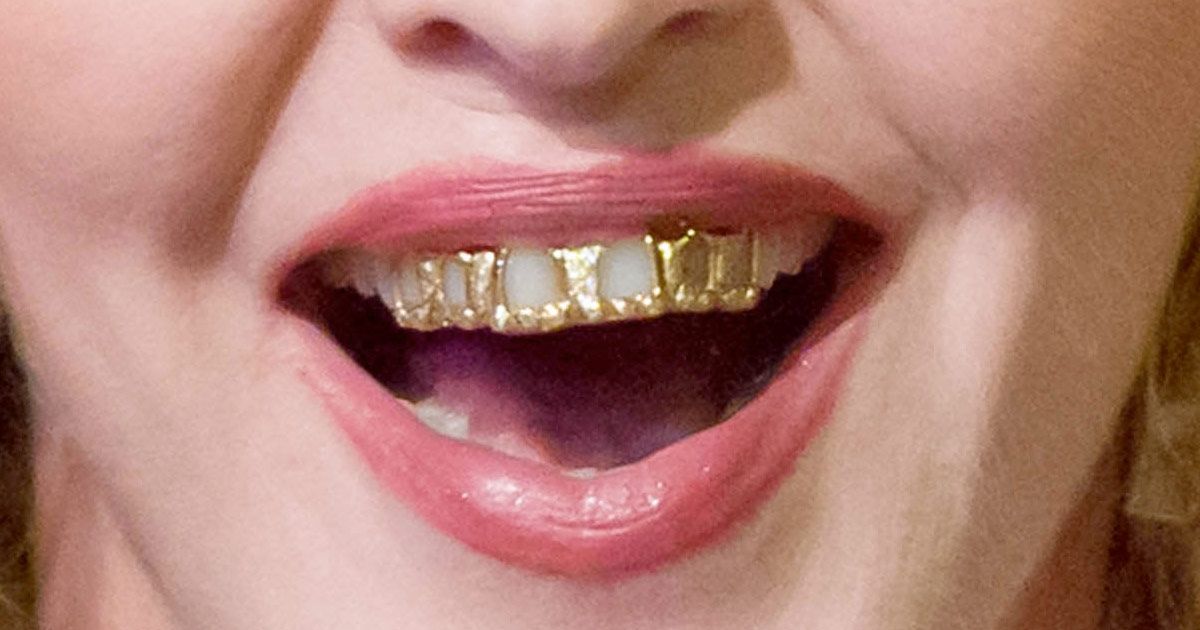 Grillz Have Risen, But Do They Harm Your Teeth?
