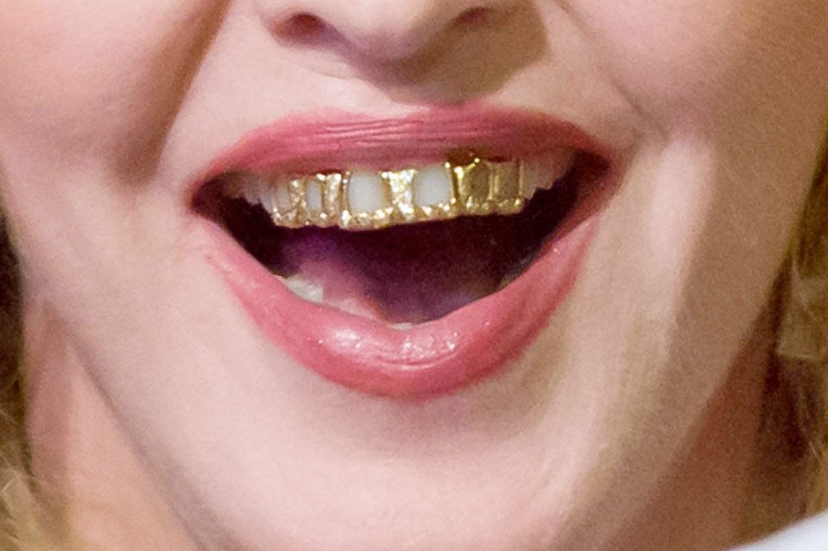 Grillz Risen, But Do They Harm