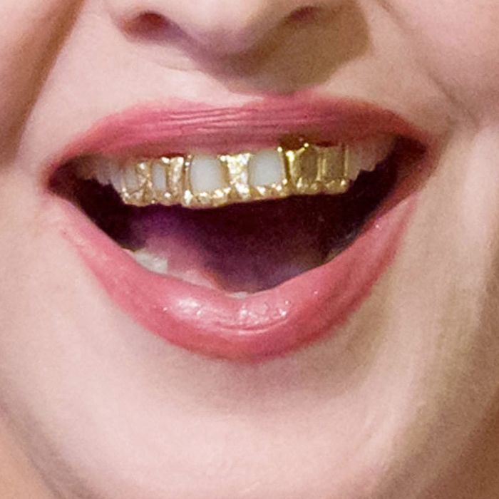 Grillz Have Risen, They Harm Your Teeth?