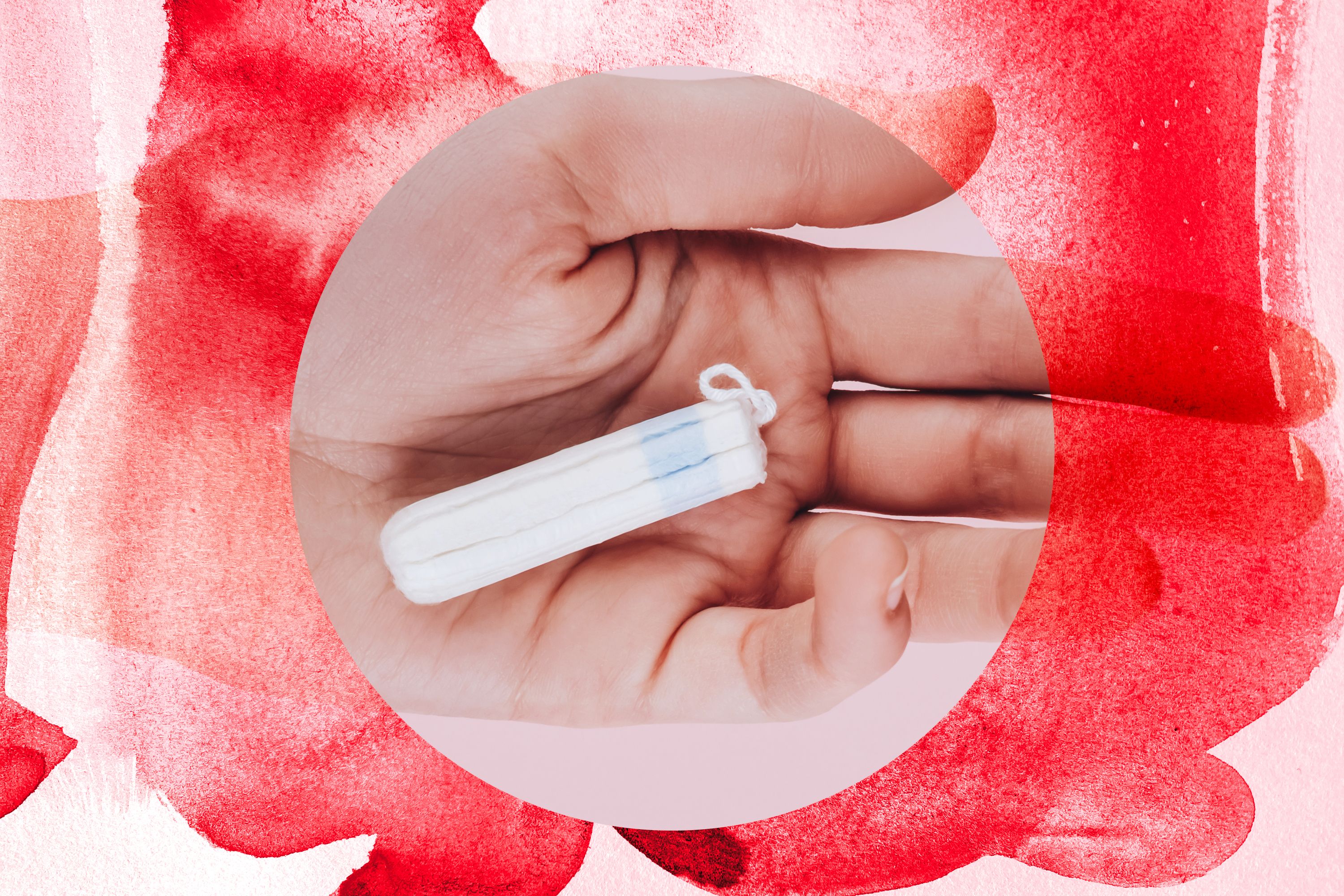 Toxic Shock Syndrome  Causes, Symptoms & Prevention 