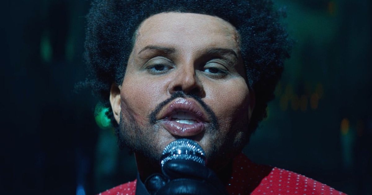 So, Did the Weeknd Get Instagram Face?