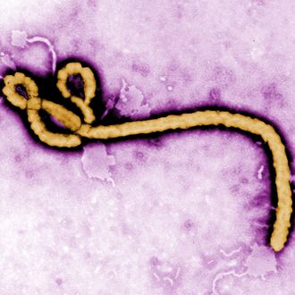 UNDATED: In this handout from the Center for Disease Control (CDC), a colorized transmission electron micrograph (TEM) of a Ebola virus virion is seen. As the Ebola virus continues to spread across parts of Africa, a second doctor infected with the disease has arrived in the U.S. for treatment. (Photo by Center for Disease Control (CDC) via Getty Images)