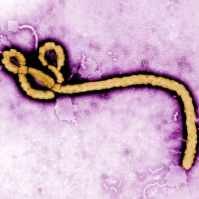 UNDATED: In this handout from the Center for Disease Control (CDC), a colorized transmission electron micrograph (TEM) of a Ebola virus virion is seen. As the Ebola virus continues to spread across parts of Africa, a second doctor infected with the disease has arrived in the U.S. for treatment. (Photo by Center for Disease Control (CDC) via Getty Images)