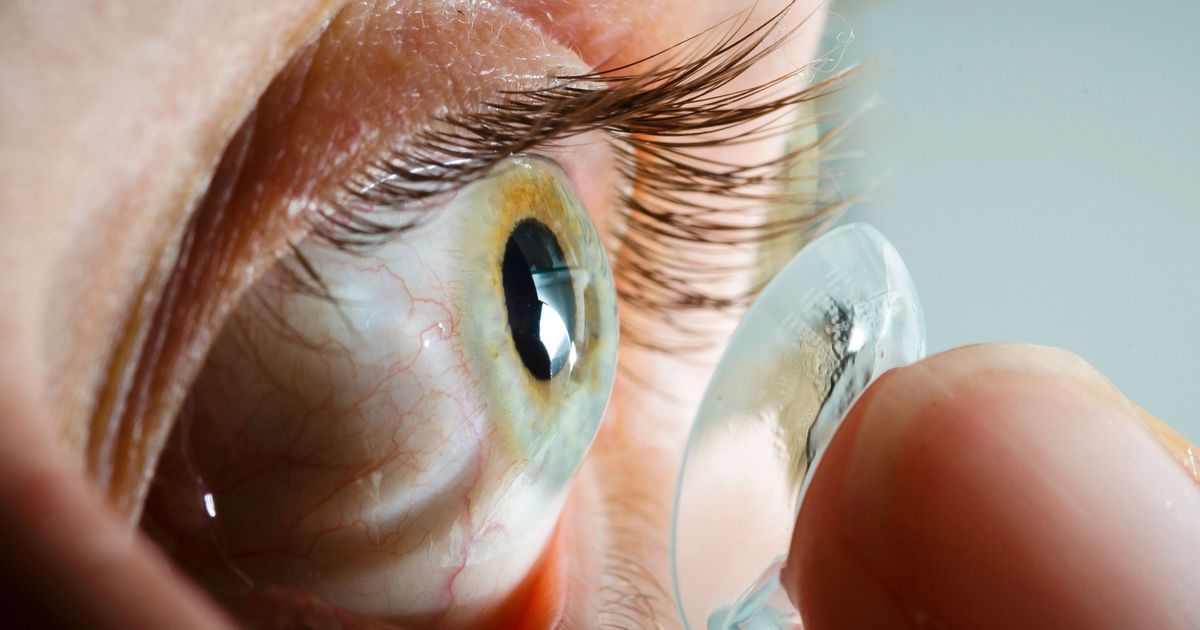 Doctors Discover 28-Year-Old Contact Lens in Woman’s Eye