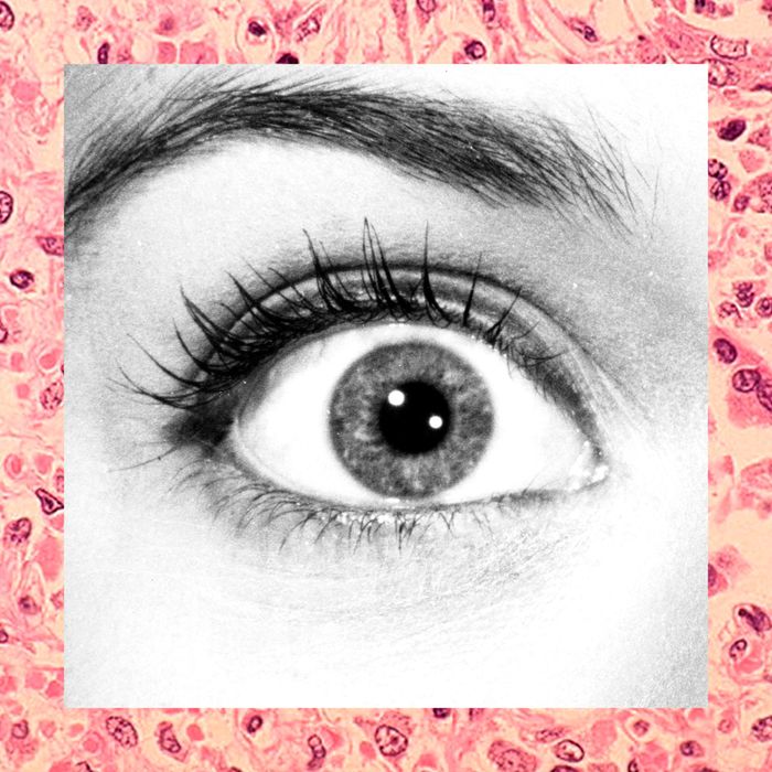 seeing-black-spots-in-your-eyes-eye-am