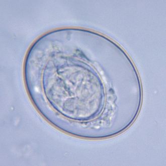 Dwarf Tapeworm eggs (Hymenolepis nana)