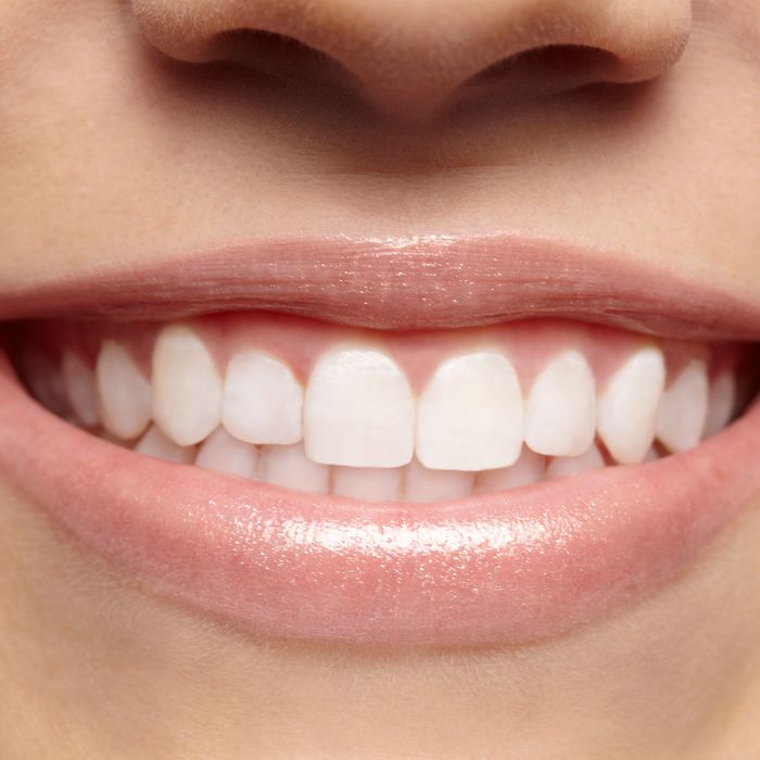 The Real Secret Behind Fancy Teeth 