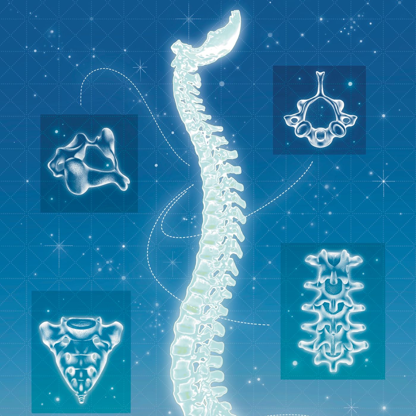 The Spinal Surgeries That Didn't Need to Happen