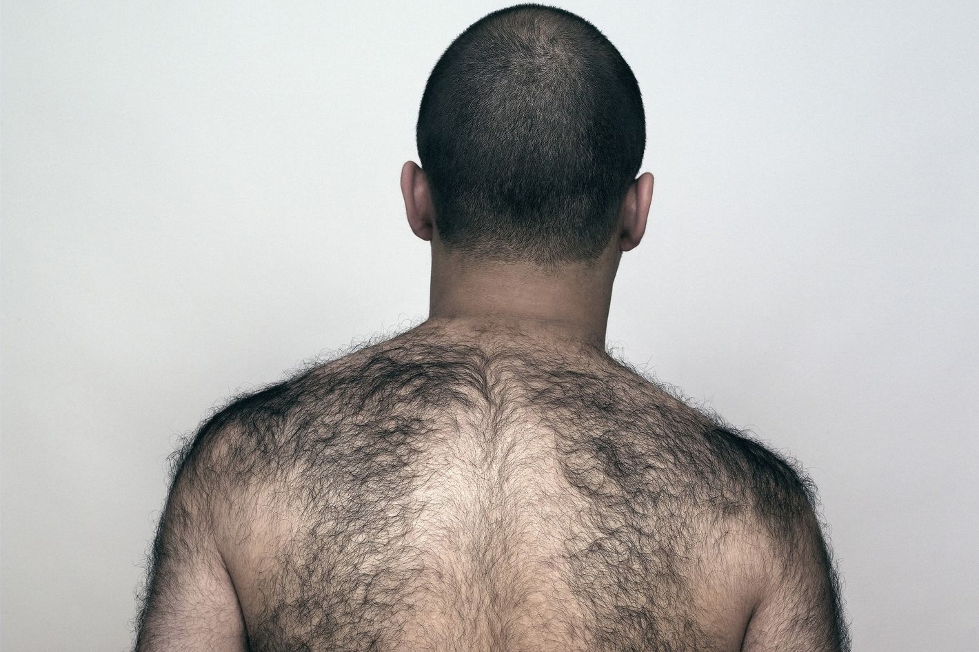 Backs why do some men have hairy What’s with