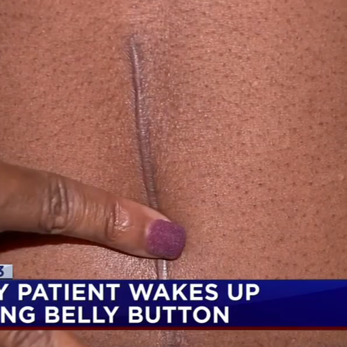 Where Did This Woman's Bellybutton Go?