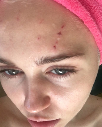 That does not look great. Miley Cyrus/Instagram
