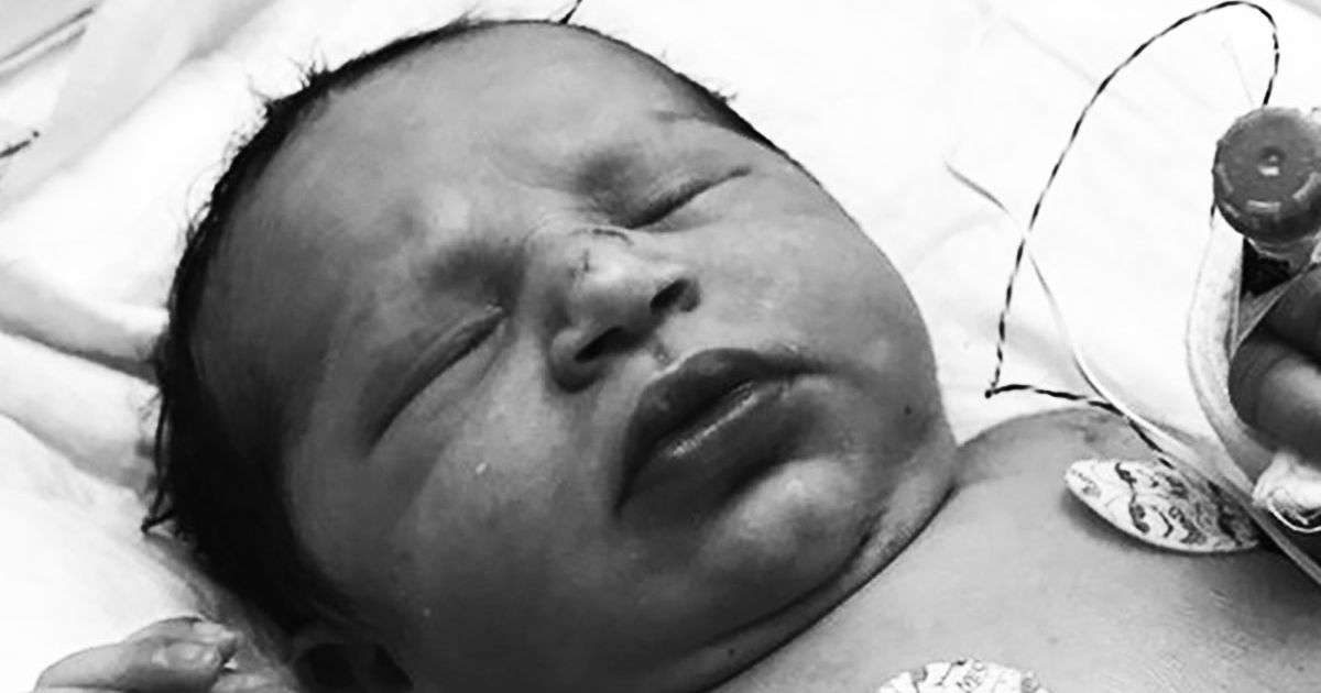 Baby Found Alive in Plastic Bag Still a Mystery