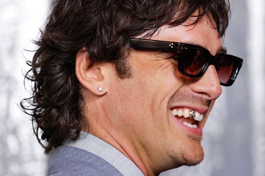 Margot Robbie and Jacob Elordi Are More Fun to Watch When They’re Weird