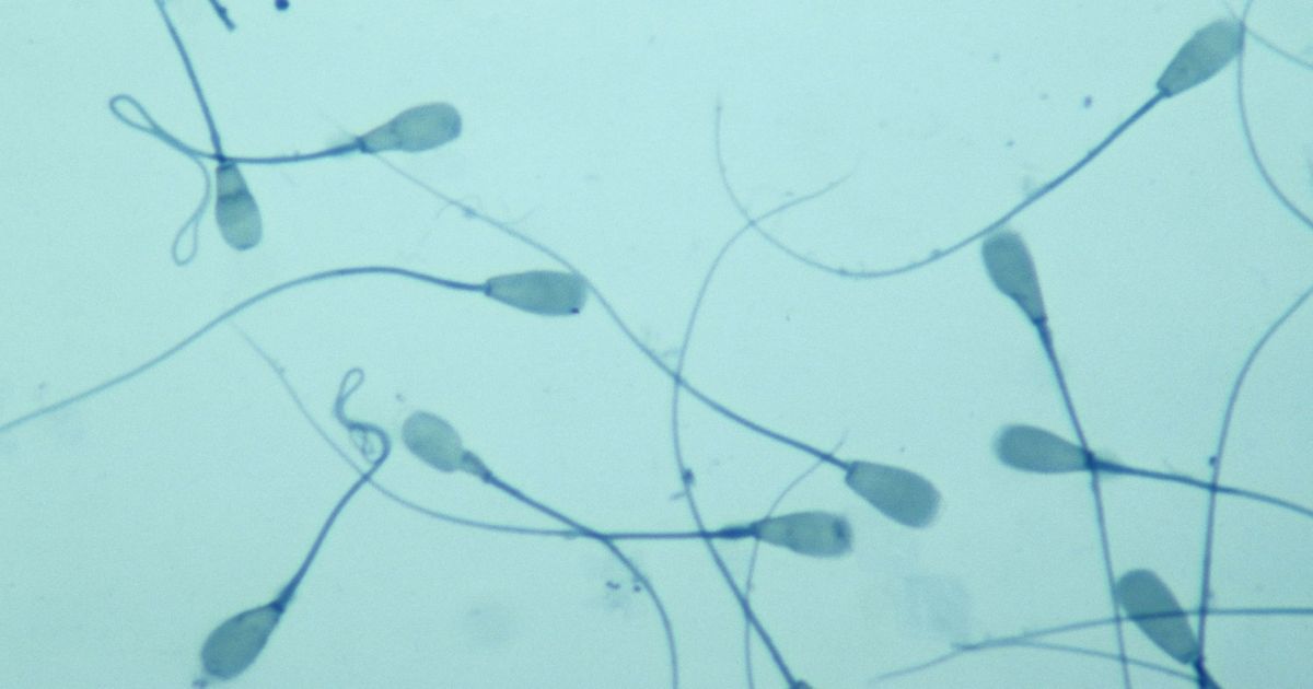 Can You Be a Sperm Donor If You’re Dead? Science of Us