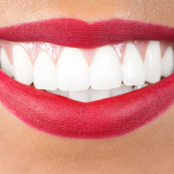 Beautiful smile with teeth