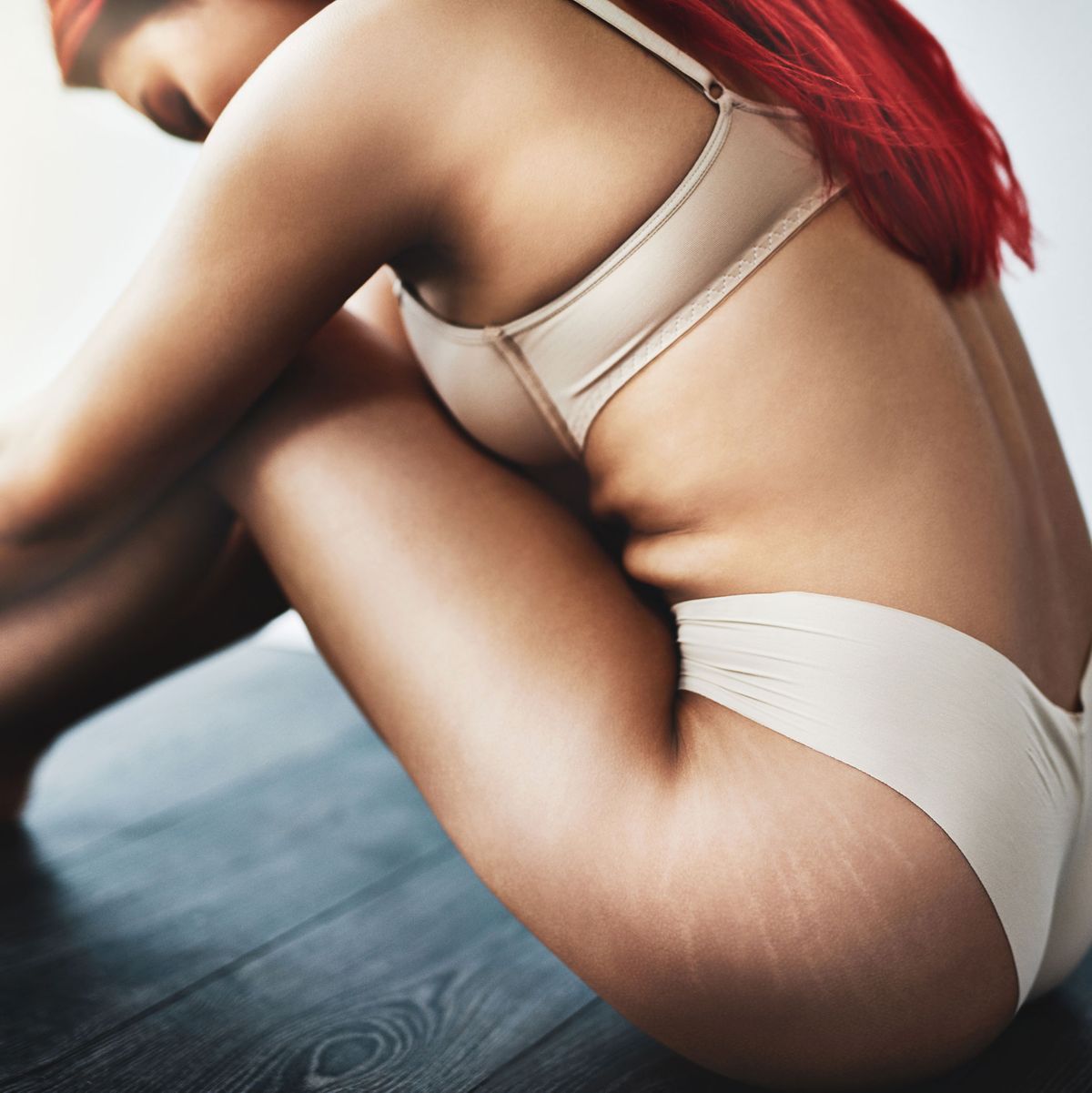 How To Get Rid Of Stretch Marks Here Are The Biggest Myths