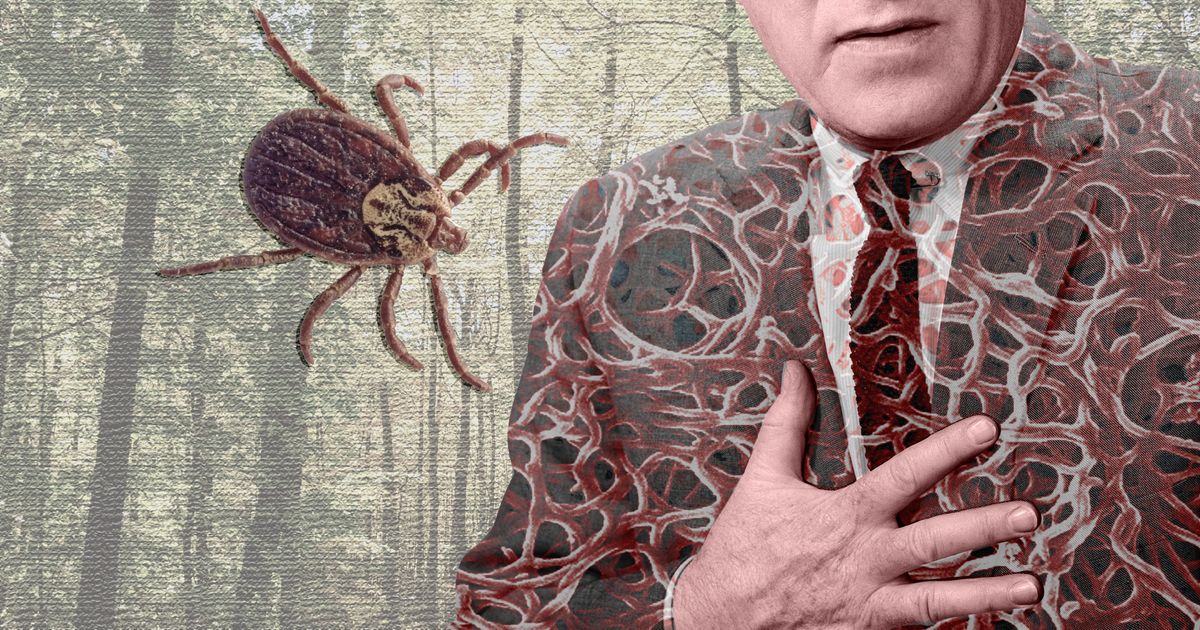 What It’s Like To Have Severe Lyme Disease