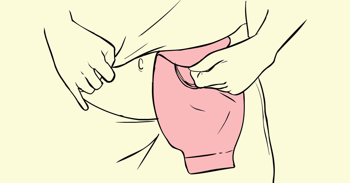 Living with a colostomy bag: 8 truths one woman wants you to know