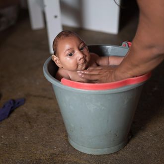 Brazil Zika Birth Defects