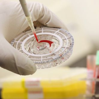 BERLIN, GERMANY - AUGUST 11: A doctor for tropical medicine prepares a blood sample for analysis during a demonstration for the media of ebola treatment capabilities at Station 59 at Charite hospital on August 11, 2014 in Berlin, Germany. The specialized quarantine unit at Station 59 is among a handful of facilities in Germany nationwide that are capable of handling ebola cases. According to media reports a German medical student currently in Ruanda is showing signs of the disease, though should he in fact have ebola it is so far unclear whether he would be flown to Germany for treatment. The disease has so far claimed over 1,000 lives in western Africa in recent weeks. (Photo by Sean Gallup/Getty Images)