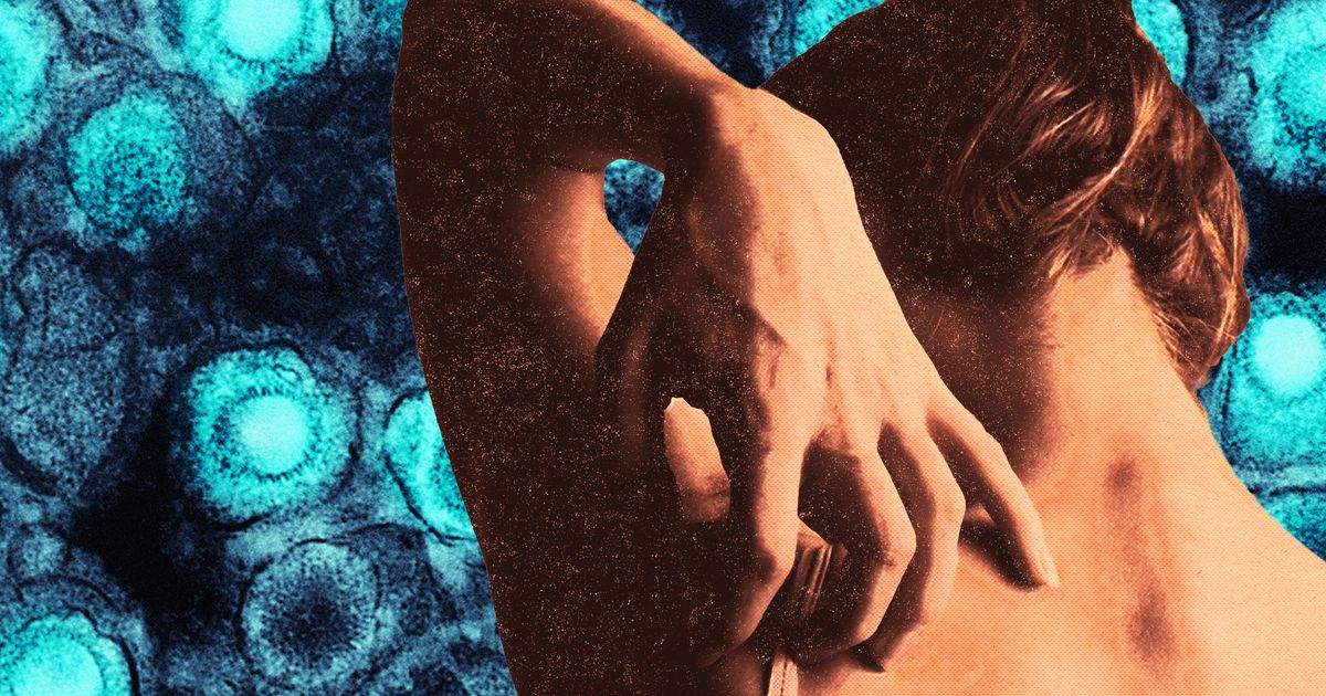 Another Thing for Millennial Women to Stress Over