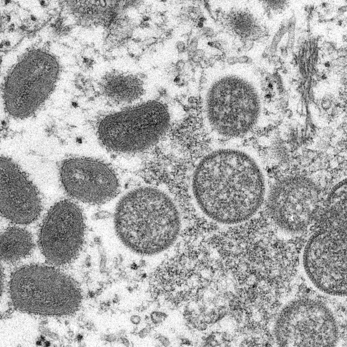 monkeypox virus outbreak - photo #23