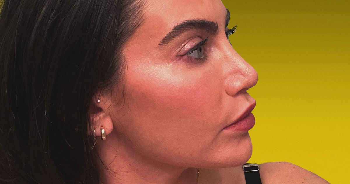 Why I Got a Nose Job in My Mid-30s