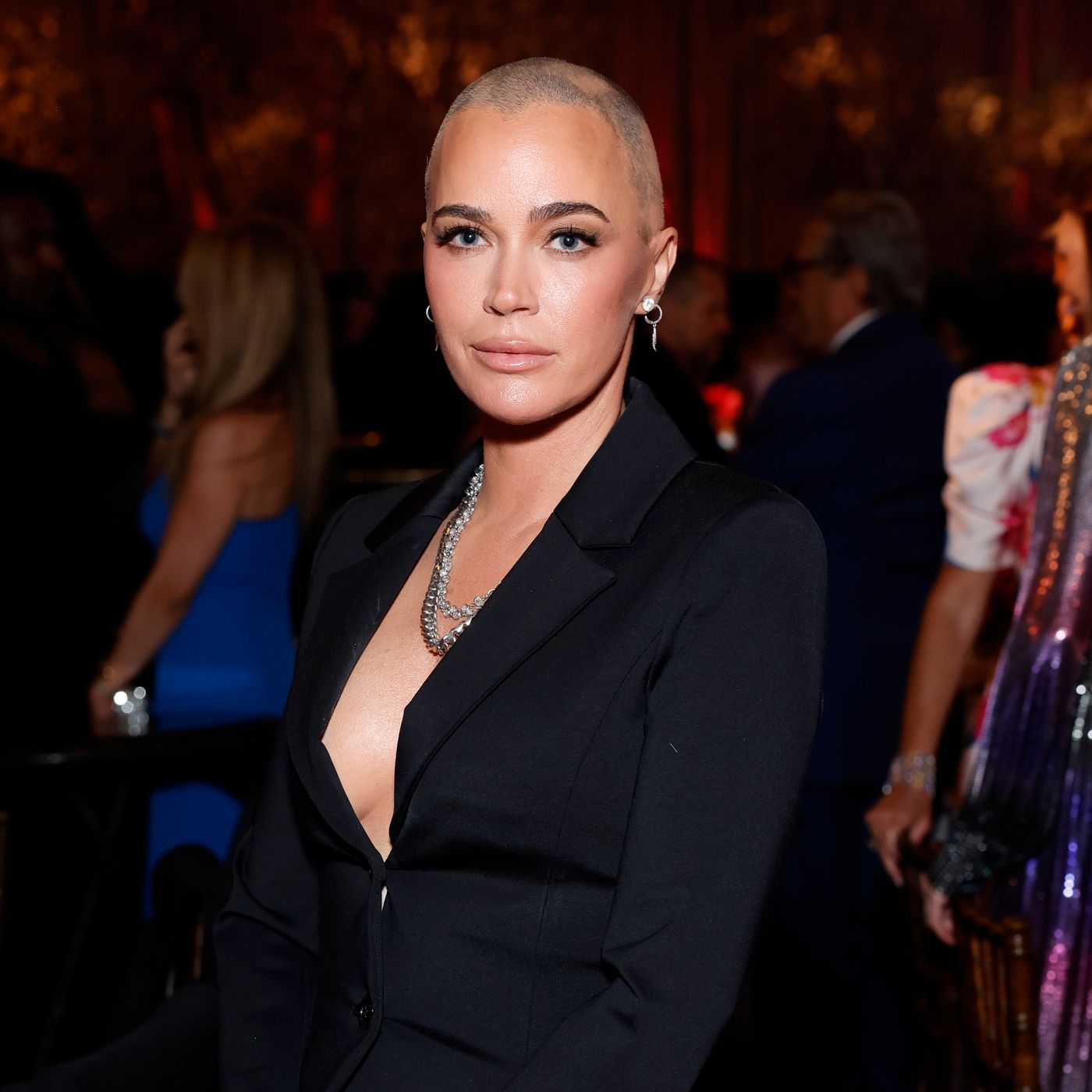 Teddi Mellencamp Shows Off Her Brain Surgery Scars