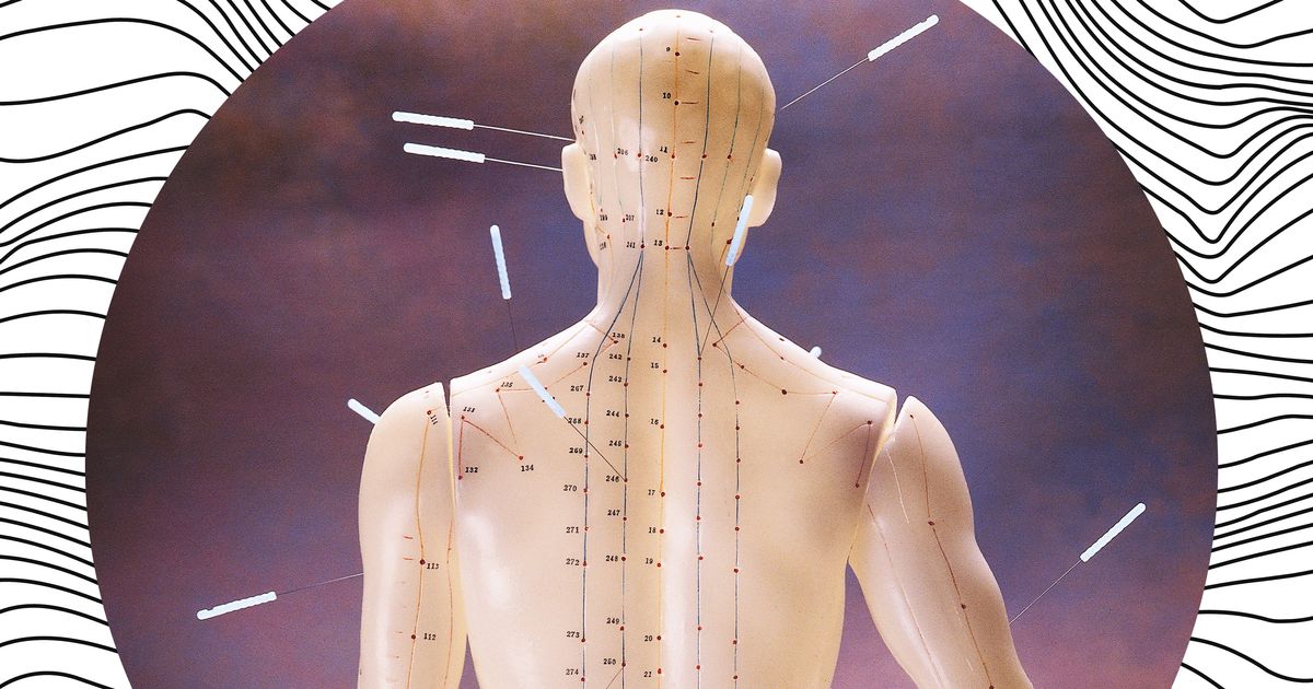 What Can Acupuncture Help With Beyond Pain?