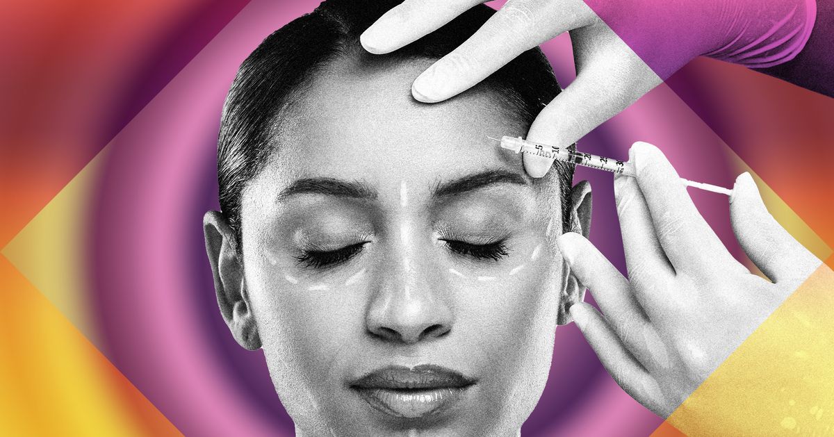 Is a Fat Transfer the Best Facial Filler?