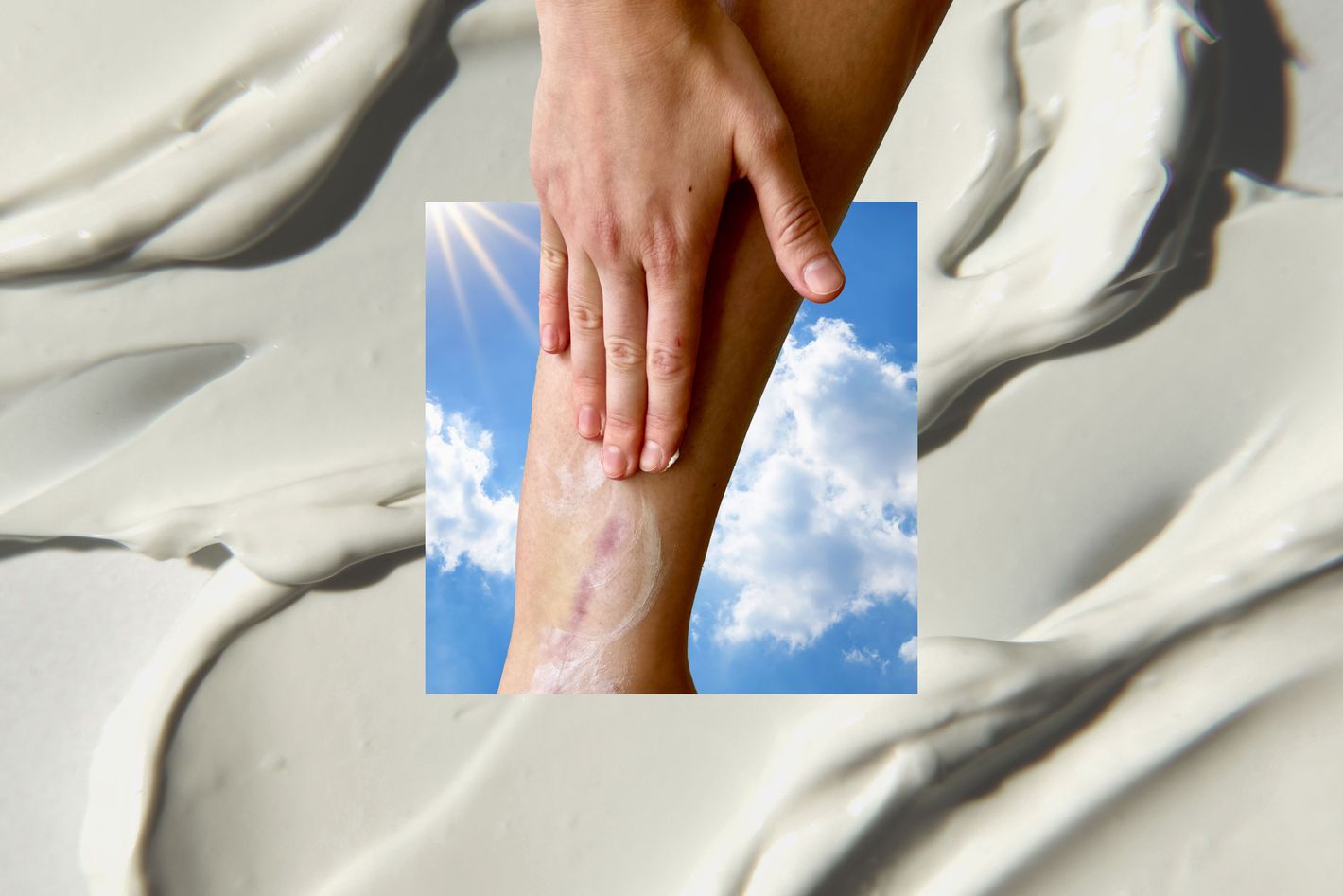 How Do I Take Care of a Scar?