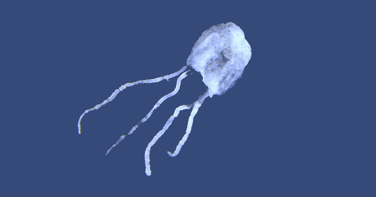 A Jellyfish Sting Causes A Sense Of Impending Doom Science Of Us
