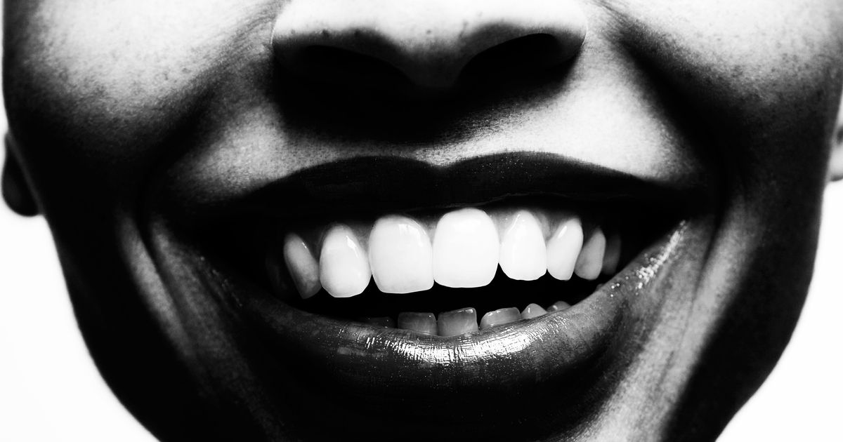 Beauty Q A Is Too Much Teeth Whitening Bad
