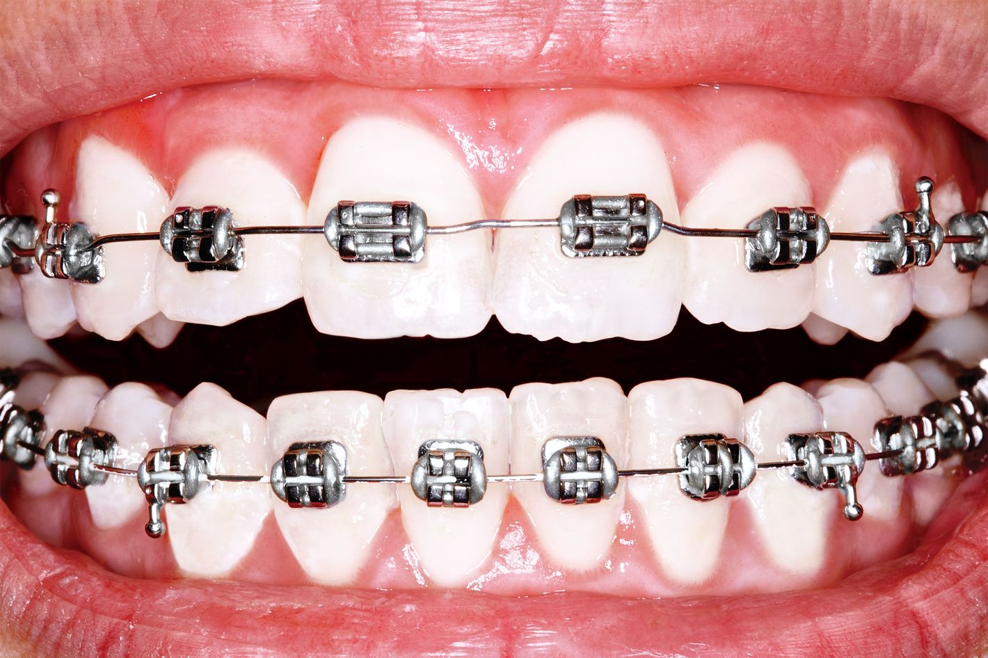 https://pyxis.nymag.com/v1/imgs/fad/257/94753e70e93838f4427b3c0a7e55c4f2fb-08-teeth.2x.h473.w710.jpg