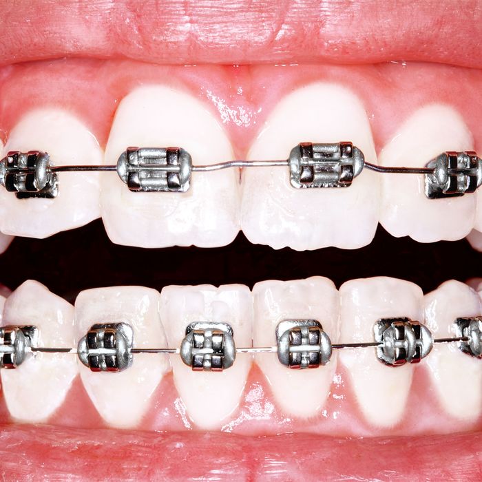 Orthodontics